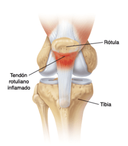 Rodilla Randa Markos